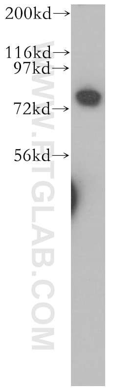 Western Blot (WB) analysis of Jurkat cells using CUX1 Polyclonal antibody (11733-1-AP)