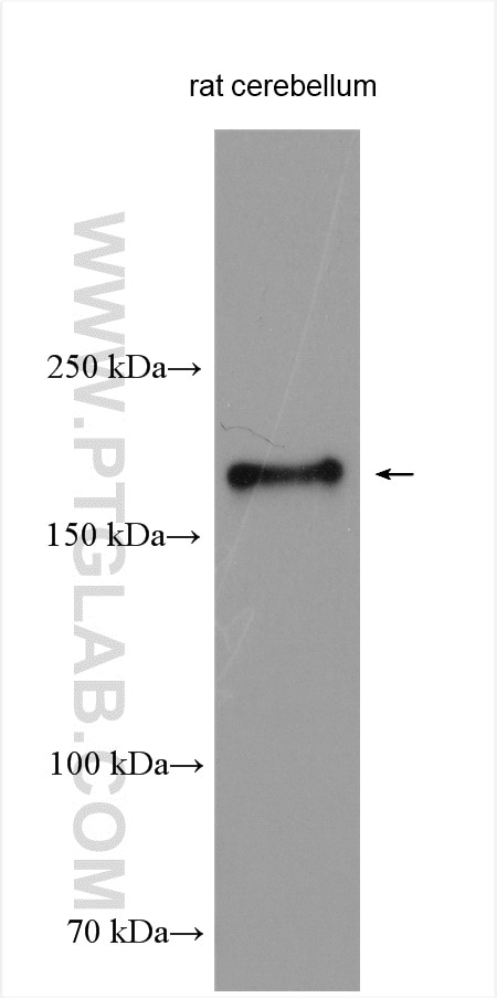 Western Blot (WB) analysis of rat cerebellum tissue using CUX2 Polyclonal antibody (24902-1-AP)