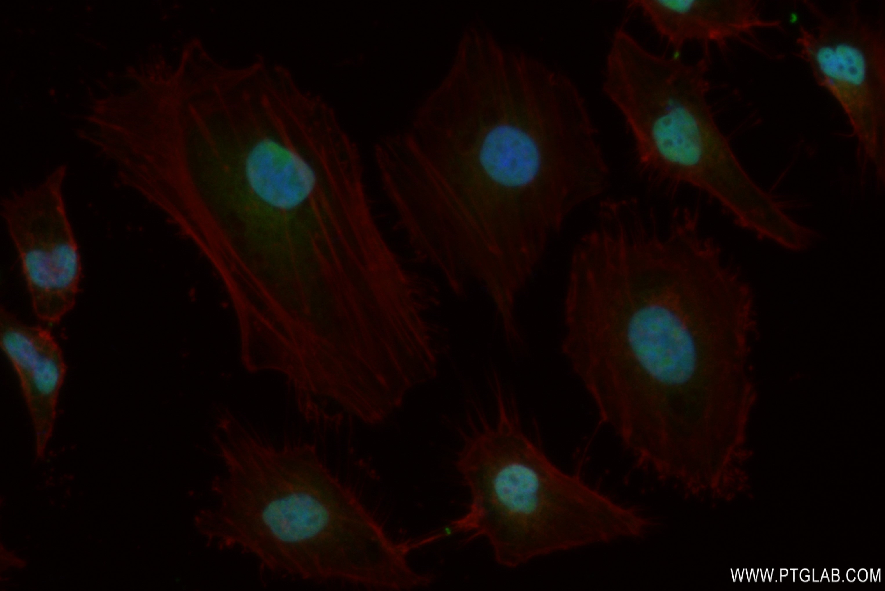 IF Staining of HeLa using 82933-1-RR