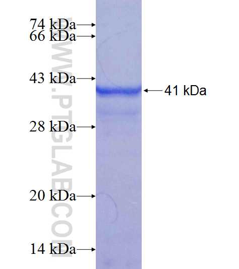 CUX2 fusion protein Ag18877 SDS-PAGE