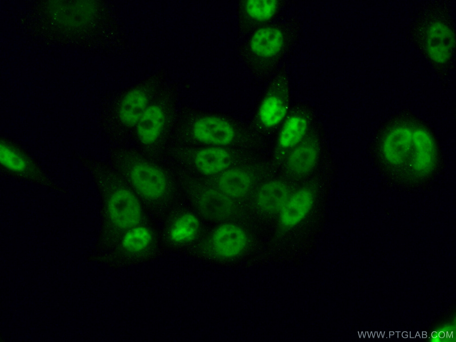 Immunofluorescence (IF) / fluorescent staining of HeLa cells using CWC15 Polyclonal antibody (25293-1-AP)