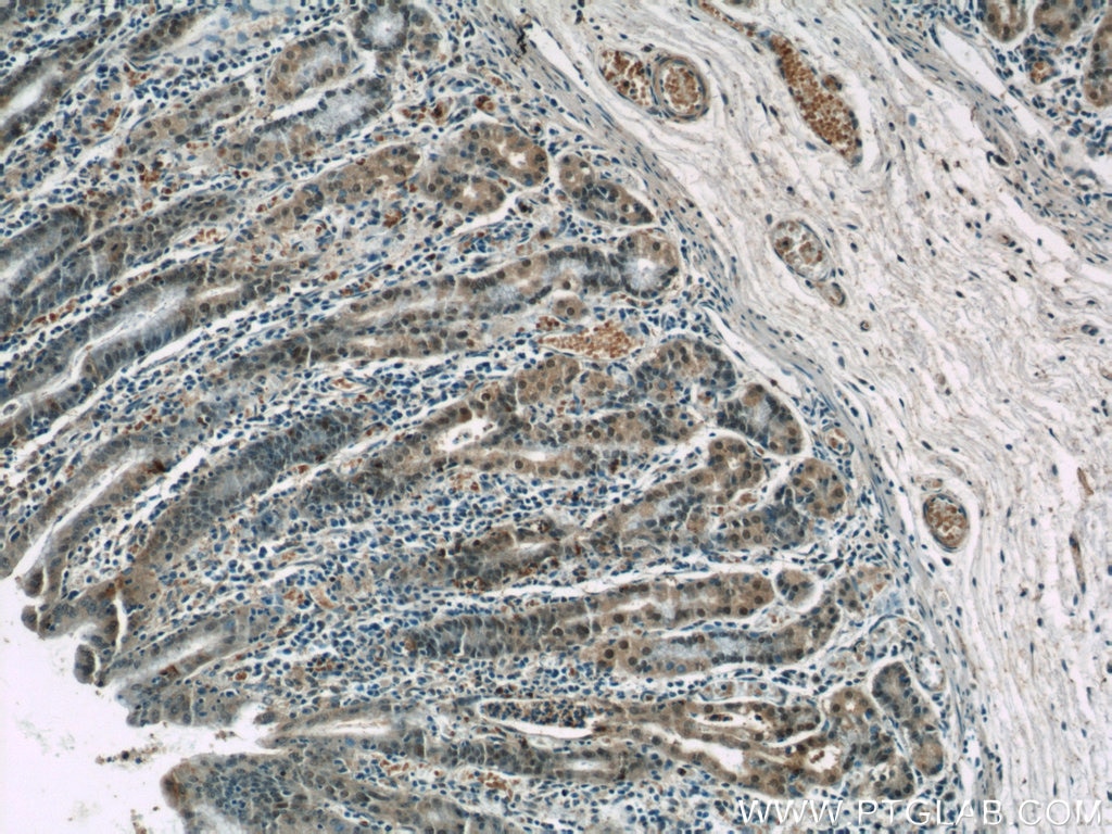 Immunohistochemistry (IHC) staining of human stomach tissue using CWC15 Polyclonal antibody (25293-1-AP)