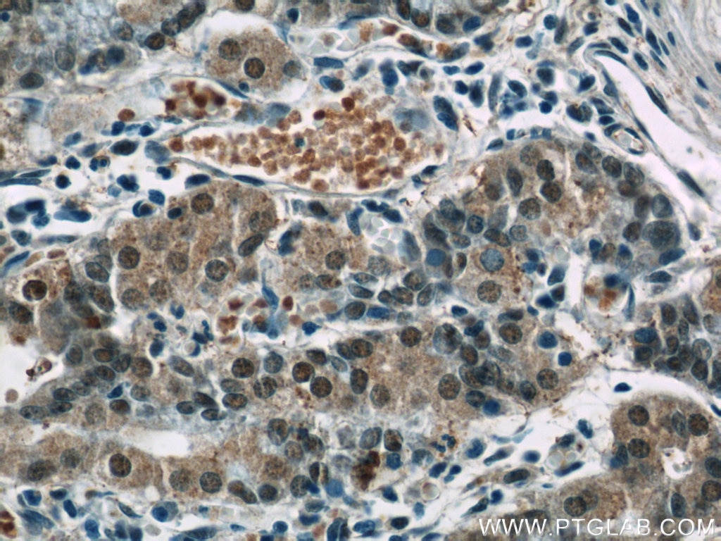 Immunohistochemistry (IHC) staining of human stomach tissue using CWC15 Polyclonal antibody (25293-1-AP)