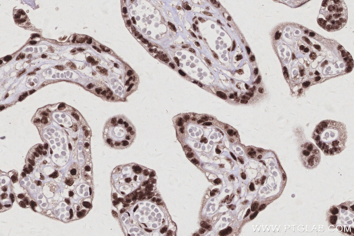 Immunohistochemistry (IHC) staining of human placenta tissue using CWC15 Polyclonal antibody (25293-1-AP)