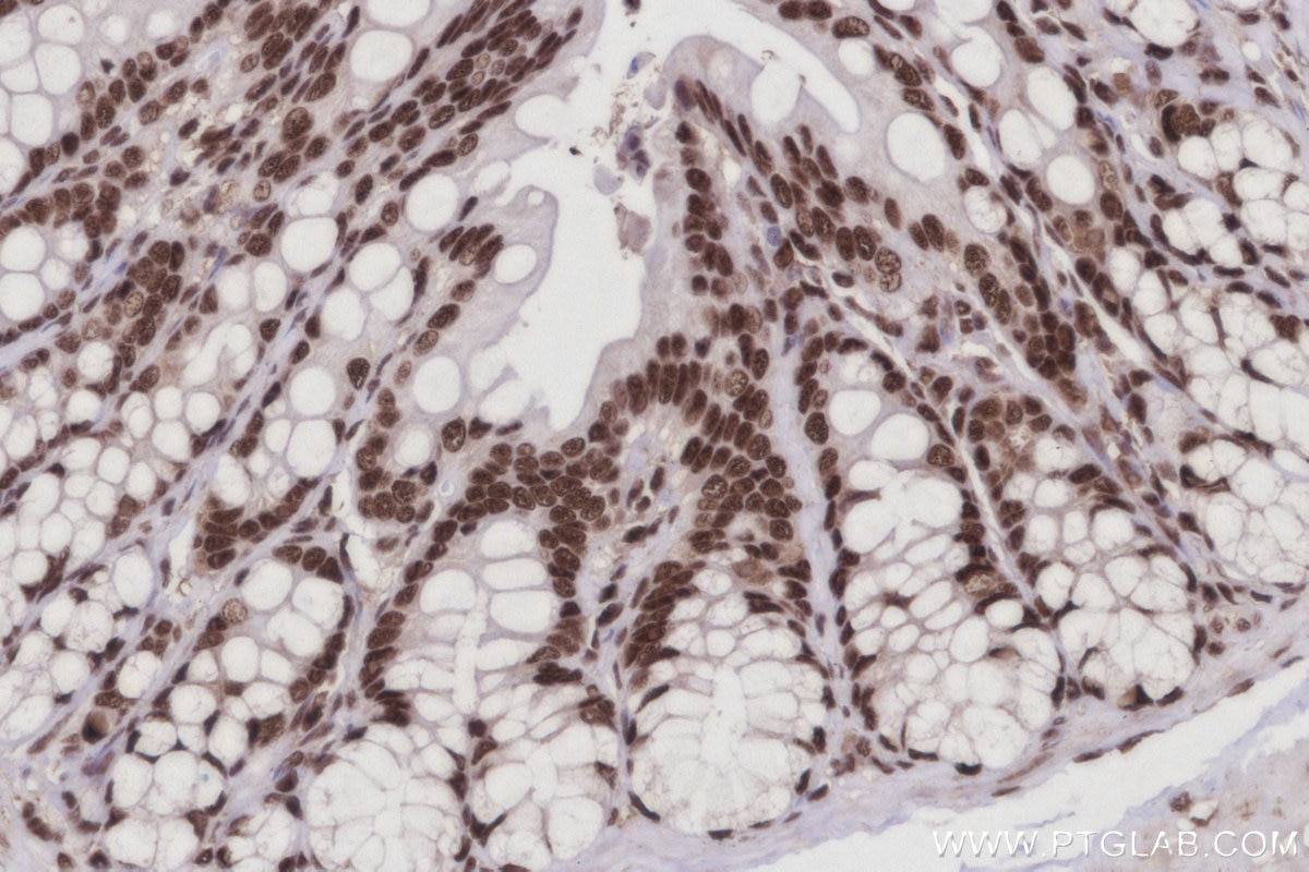 Immunohistochemistry (IHC) staining of rat colon tissue using CWC15 Polyclonal antibody (25293-1-AP)