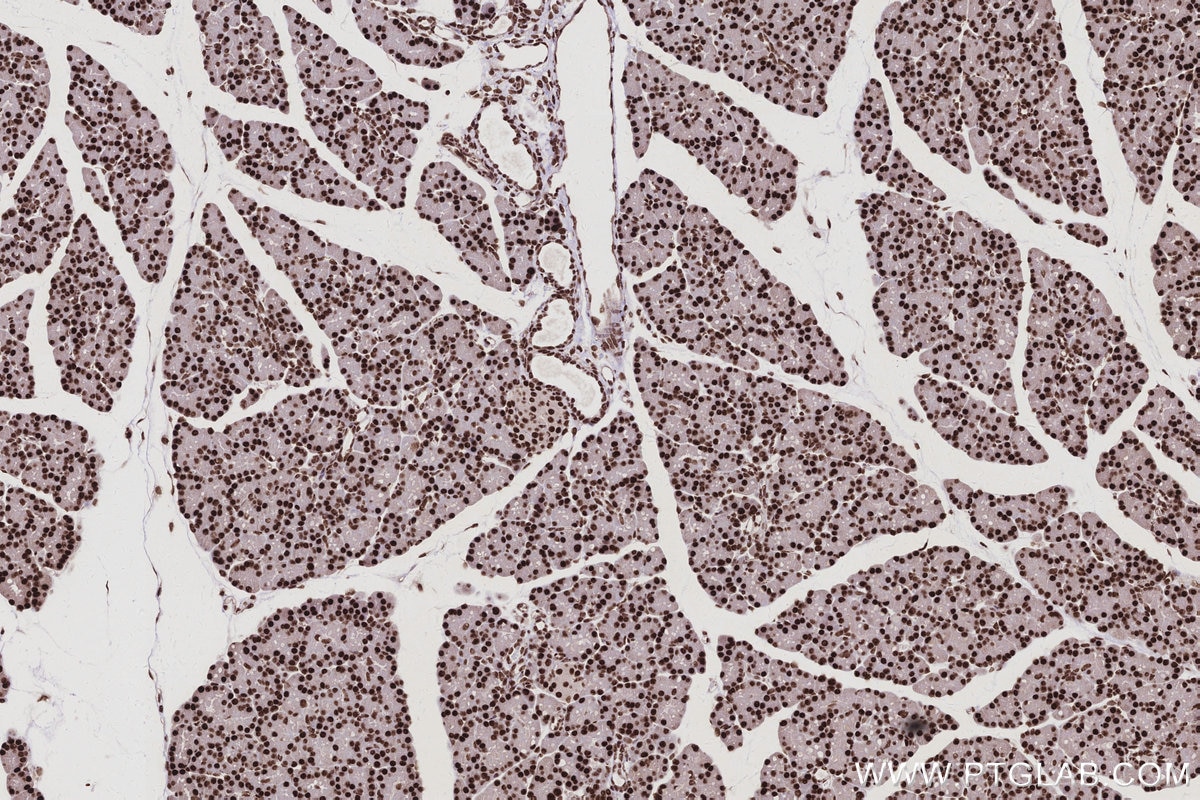 Immunohistochemistry (IHC) staining of rat pancreas tissue using CWC15 Polyclonal antibody (25293-1-AP)