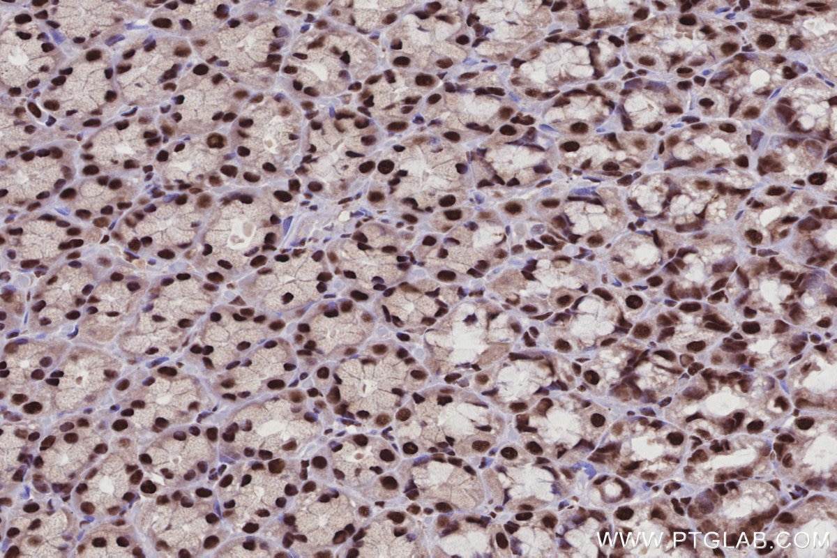 Immunohistochemistry (IHC) staining of rat stomach tissue using CWC15 Polyclonal antibody (25293-1-AP)