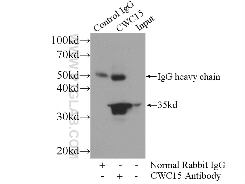 Immunoprecipitation (IP) experiment of HeLa cells using CWC15 Polyclonal antibody (25293-1-AP)