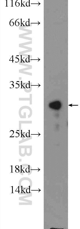 Western Blot (WB) analysis of mouse liver tissue using CWC15 Polyclonal antibody (25293-1-AP)