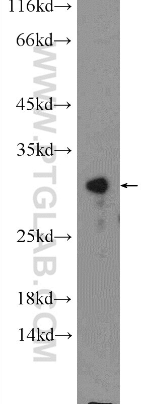 WB analysis of mouse liver using 25293-1-AP