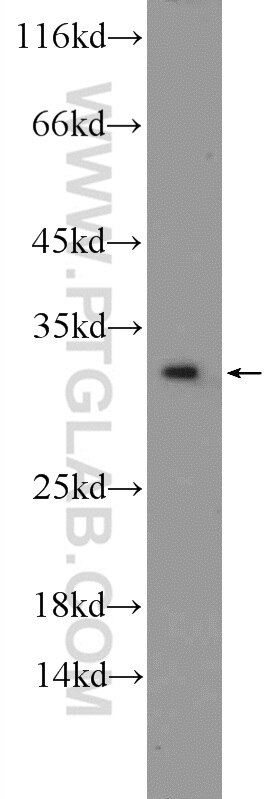 Western Blot (WB) analysis of Jurkat cells using CWC15 Polyclonal antibody (25293-1-AP)