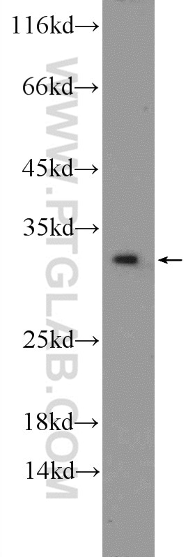 Western Blot (WB) analysis of Jurkat cells using CWC15 Polyclonal antibody (25293-1-AP)