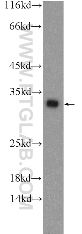 Western Blot (WB) analysis of HeLa cells using CWC15 Polyclonal antibody (25293-1-AP)