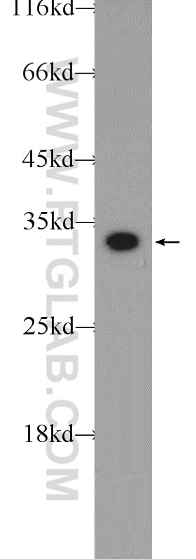 Western Blot (WB) analysis of PC-3 cells using CWC15 Polyclonal antibody (25293-1-AP)