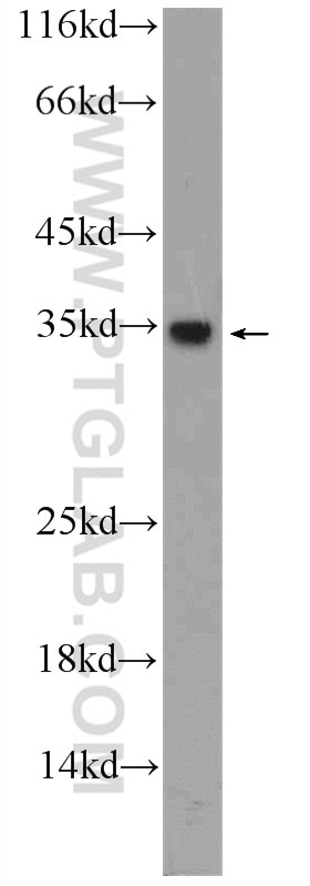 Western Blot (WB) analysis of HepG2 cells using CWC15 Polyclonal antibody (25293-1-AP)