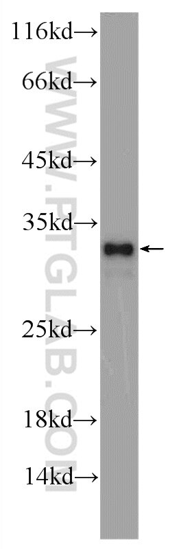 Western Blot (WB) analysis of SW 1990 cells using CWC15 Polyclonal antibody (25293-1-AP)