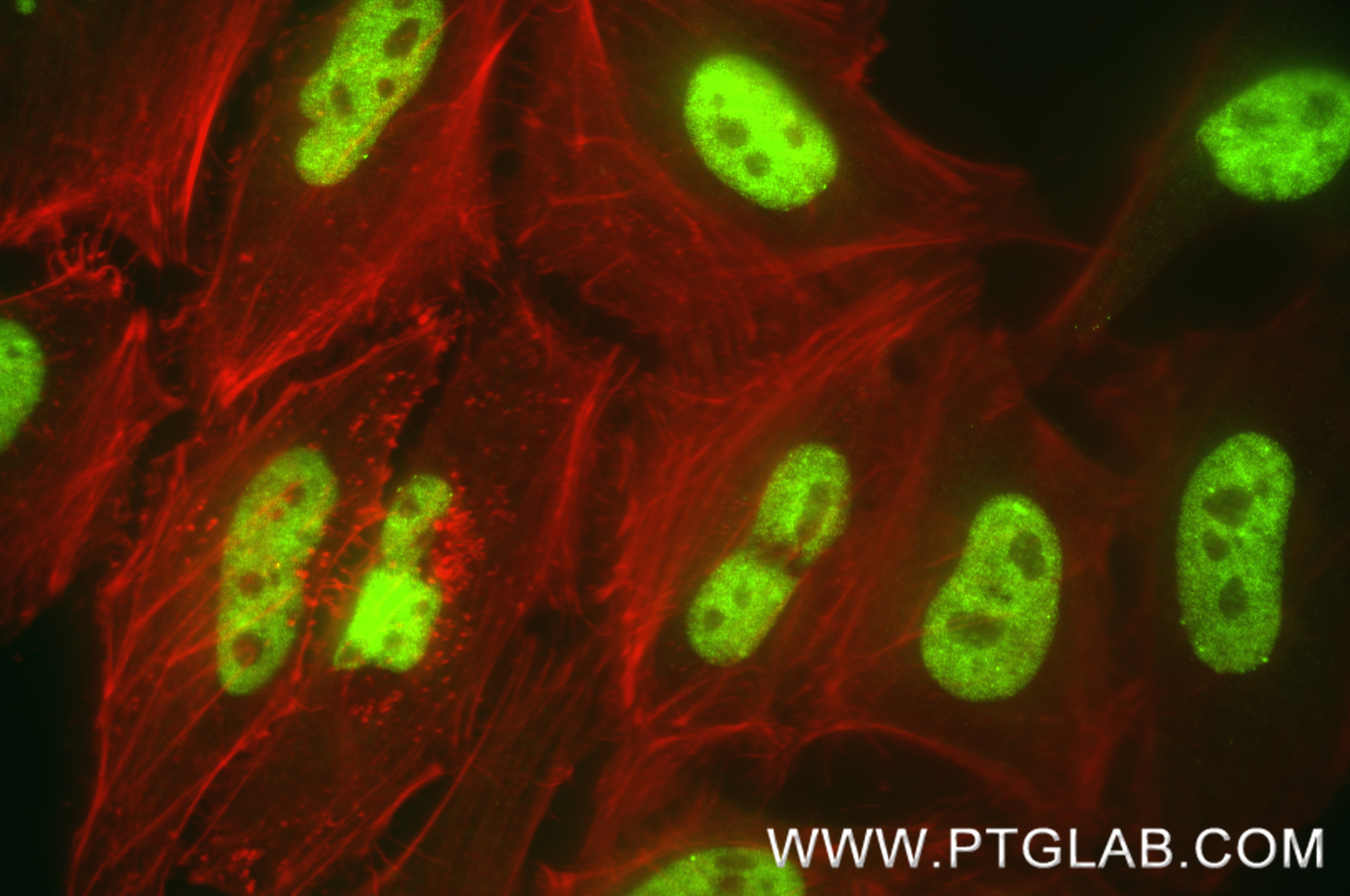 Immunofluorescence (IF) / fluorescent staining of HeLa cells using CWC15 Recombinant monoclonal antibody (87890-1-RR)