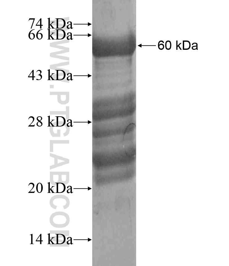 CWC15 fusion protein Ag18116 SDS-PAGE