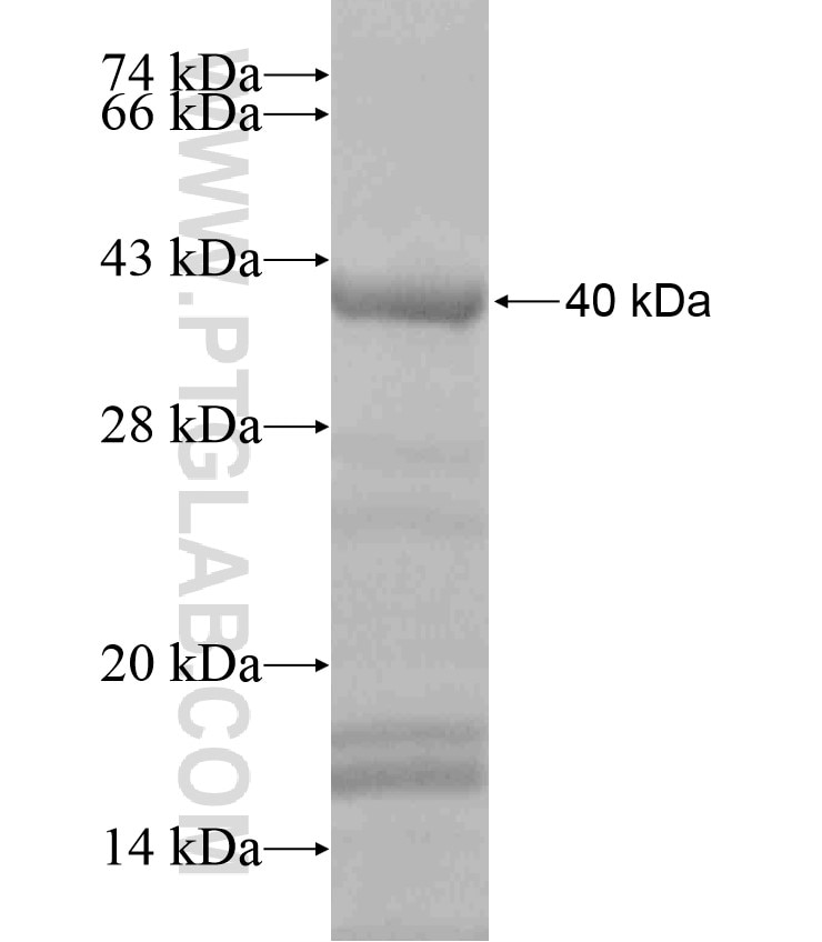 CWC15 fusion protein Ag18323 SDS-PAGE