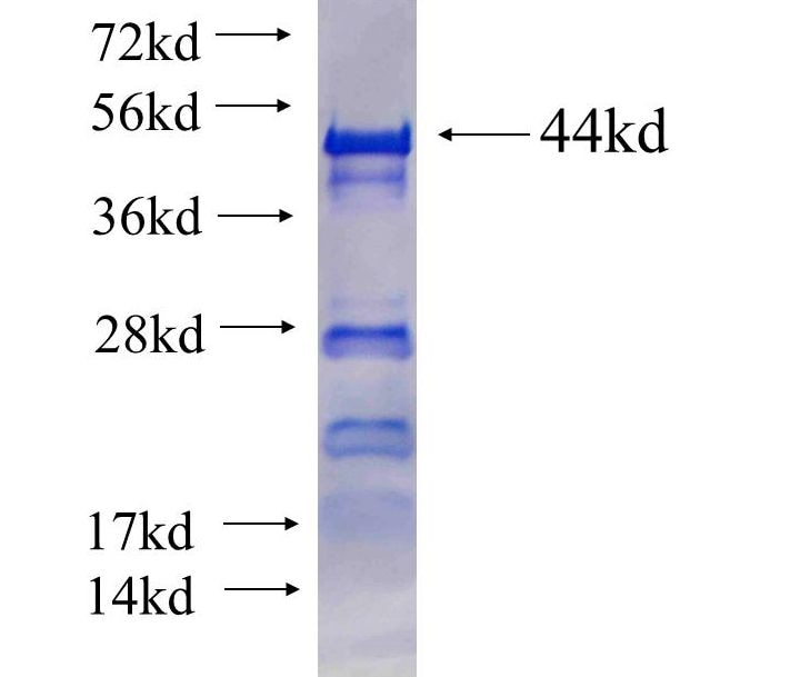 CWC22 fusion protein Ag25466 SDS-PAGE