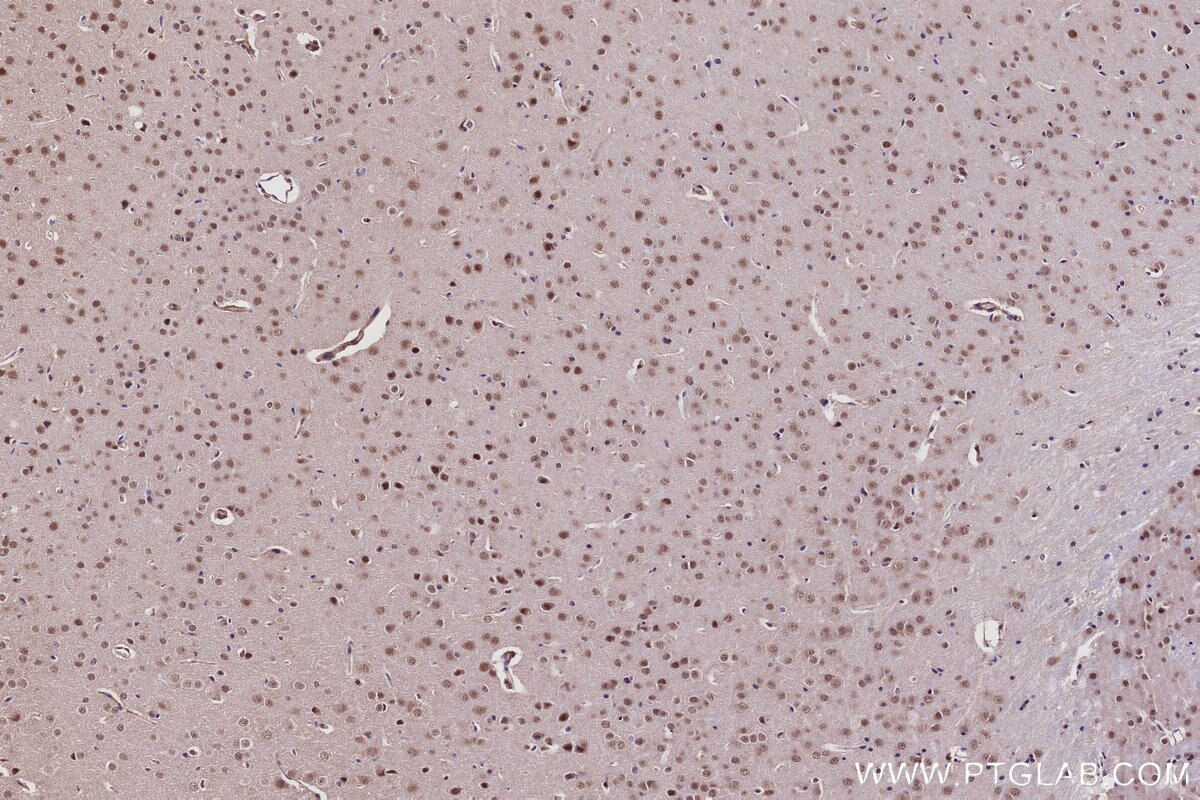 Immunohistochemistry (IHC) staining of mouse brain tissue using CWF19L1 Polyclonal antibody (31700-1-AP)