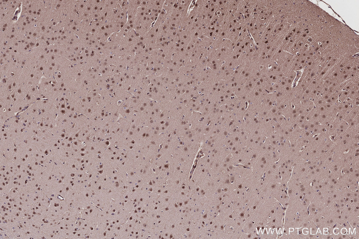 Immunohistochemistry (IHC) staining of rat brain tissue using CWF19L1 Polyclonal antibody (31700-1-AP)