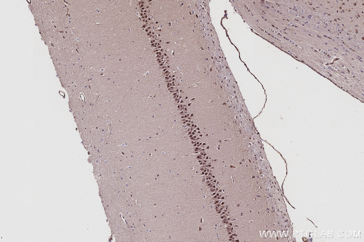 Immunohistochemistry (IHC) staining of rat brain tissue using CWF19L1 Polyclonal antibody (31700-1-AP)