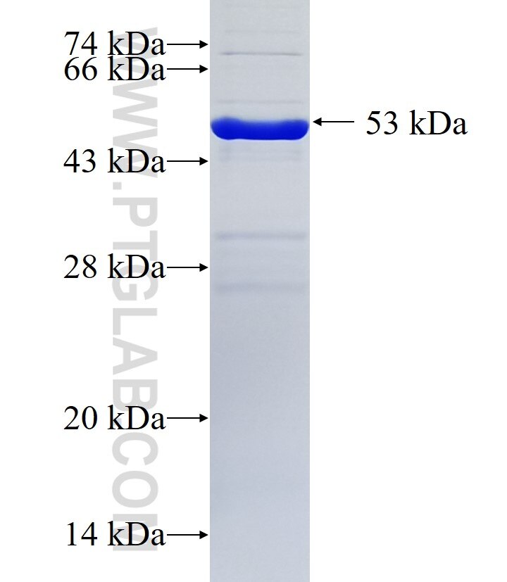 CWF19L1 fusion protein Ag36356 SDS-PAGE
