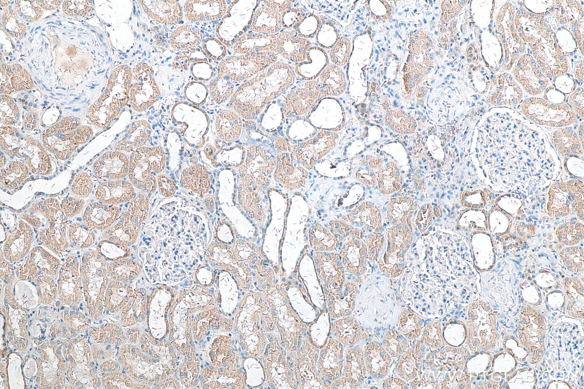 Immunohistochemistry (IHC) staining of human kidney tissue using CWF19L2 Polyclonal antibody (24872-1-AP)