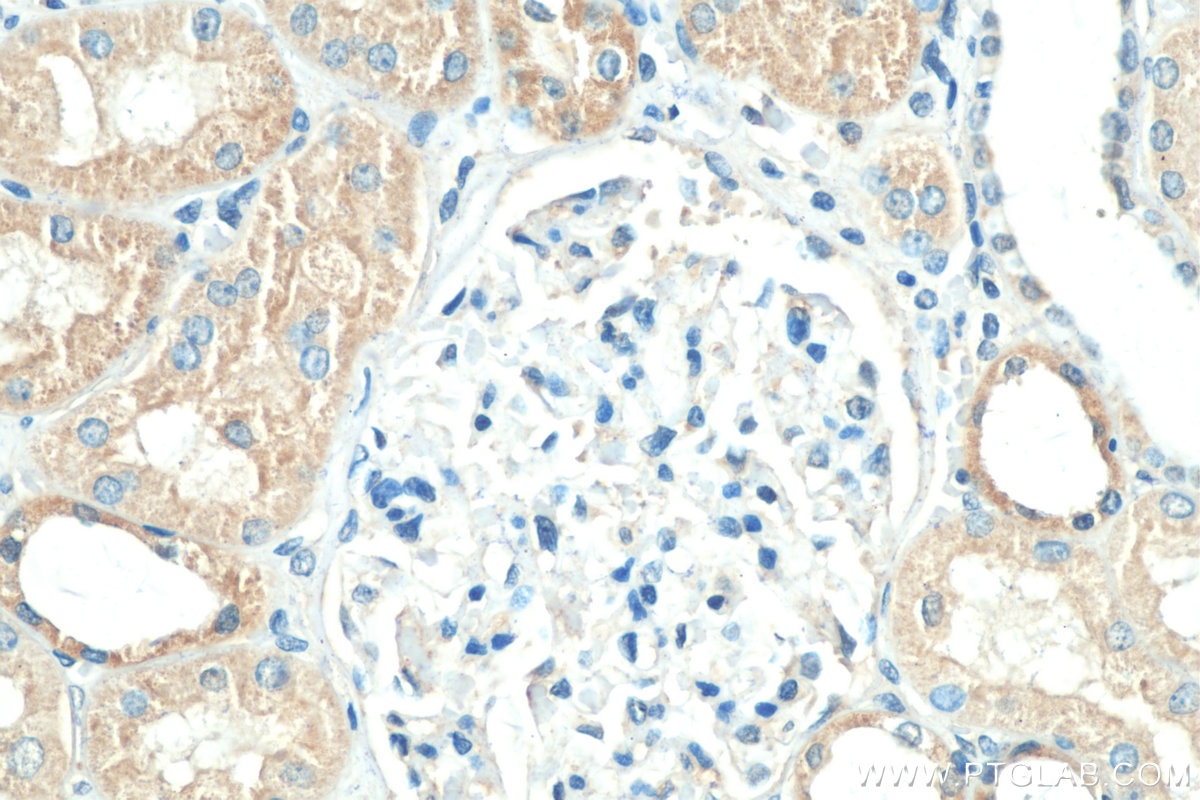 Immunohistochemistry (IHC) staining of human kidney tissue using CWF19L2 Polyclonal antibody (24872-1-AP)