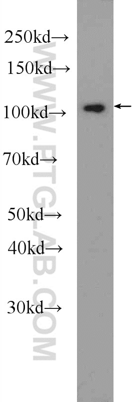 WB analysis of PC-3 using 24872-1-AP