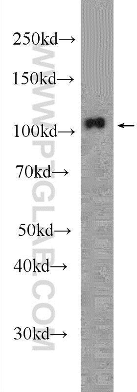 Western Blot (WB) analysis of HeLa cells using CWF19L2 Polyclonal antibody (24872-1-AP)