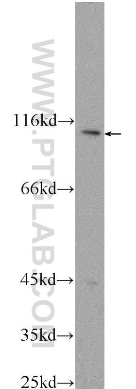 WB analysis of HEK-293 using 24872-1-AP