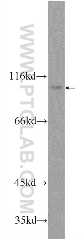 Western Blot (WB) analysis of Jurkat cells using CWF19L2 Polyclonal antibody (24872-1-AP)