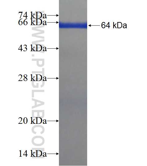 CWF19L2 fusion protein Ag21738 SDS-PAGE