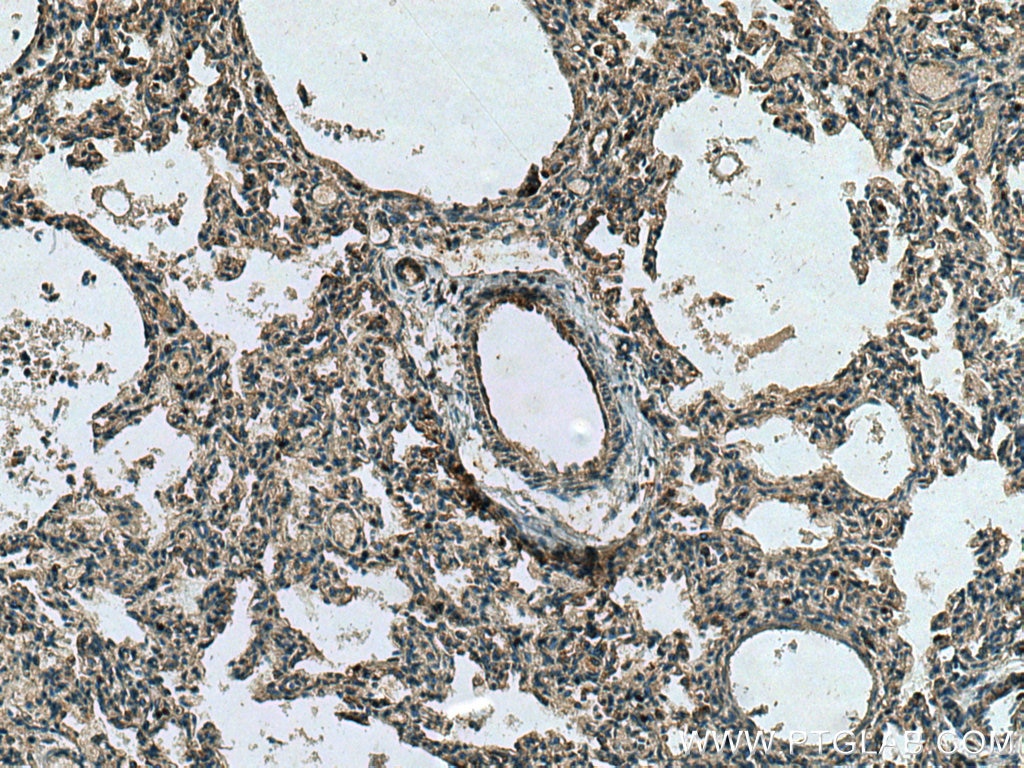 Immunohistochemistry (IHC) staining of human lung tissue using CX3CL1 Polyclonal antibody (10108-2-AP)