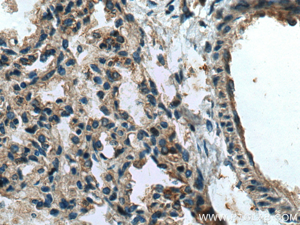 Immunohistochemistry (IHC) staining of human lung tissue using CX3CL1 Polyclonal antibody (10108-2-AP)