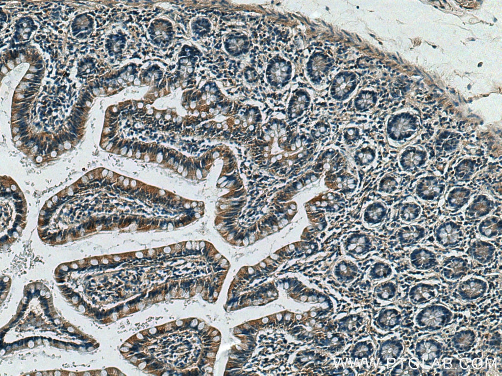 Immunohistochemistry (IHC) staining of human small intestine tissue using CX3CL1 Polyclonal antibody (10108-2-AP)