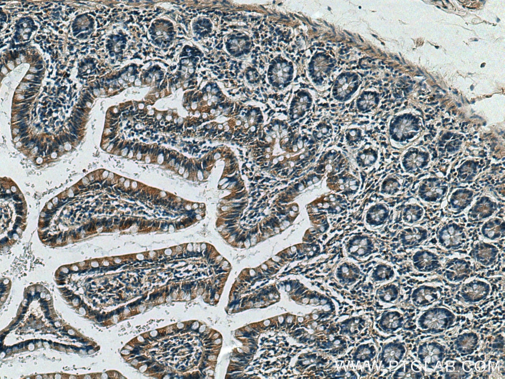 IHC staining of human small intestine using 10108-2-AP