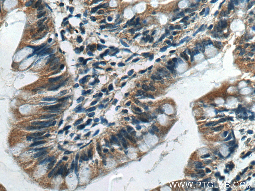 Immunohistochemistry (IHC) staining of human small intestine tissue using CX3CL1 Polyclonal antibody (10108-2-AP)