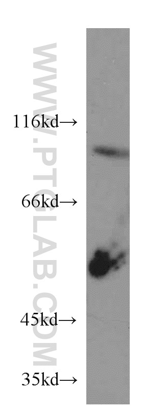 Western Blot (WB) analysis of human brain tissue using CX3CL1 Polyclonal antibody (10108-2-AP)