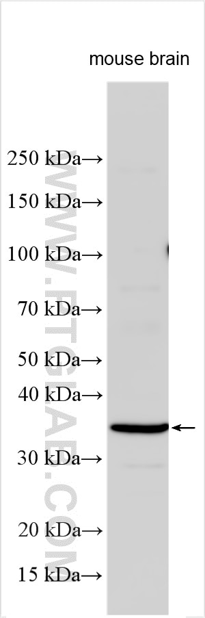 Various lysates were subjected to SDS PAGE followed by western blot with 32529-1-AP (CX3CL1 antibody) at dilution of 1:1500 incubated at room temperature for 1.5 hours. Western Blot (WB) analysis of various lysates using CX3CL1 Polyclonal antibody (32529-1-AP)