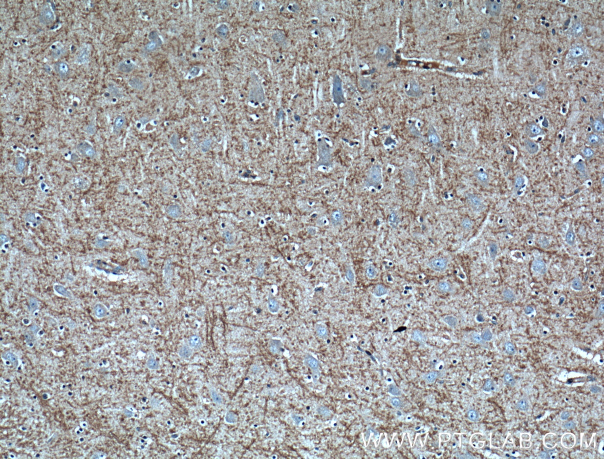 Immunohistochemistry (IHC) staining of human brain tissue using CX3CL1 Monoclonal antibody (60339-1-Ig)