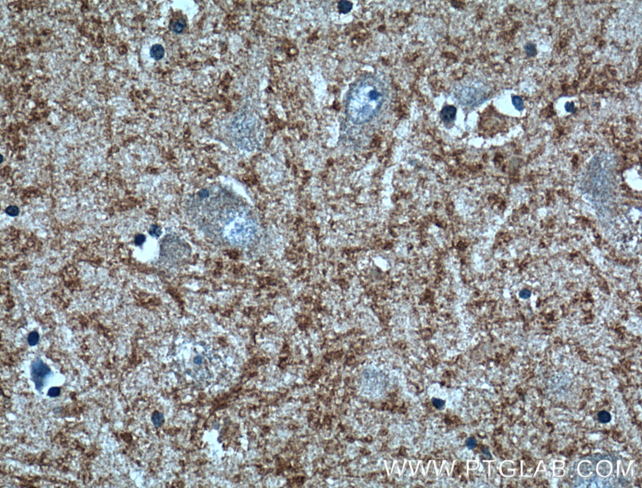 Immunohistochemistry (IHC) staining of human brain tissue using CX3CL1 Monoclonal antibody (60339-1-Ig)