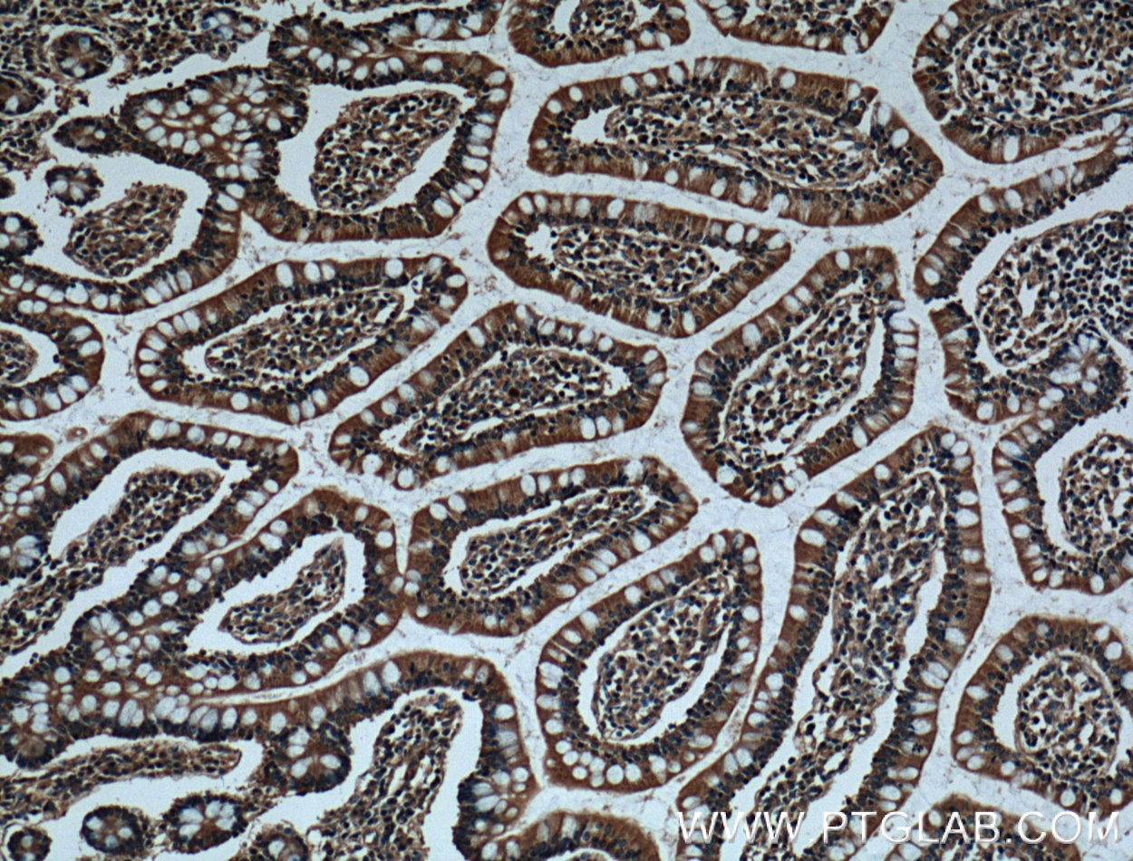 Immunohistochemistry (IHC) staining of human small intestine tissue using CX3CL1 Monoclonal antibody (60339-1-Ig)