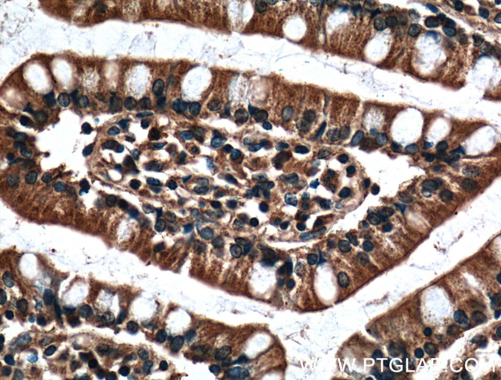 Immunohistochemistry (IHC) staining of human small intestine tissue using CX3CL1 Monoclonal antibody (60339-1-Ig)