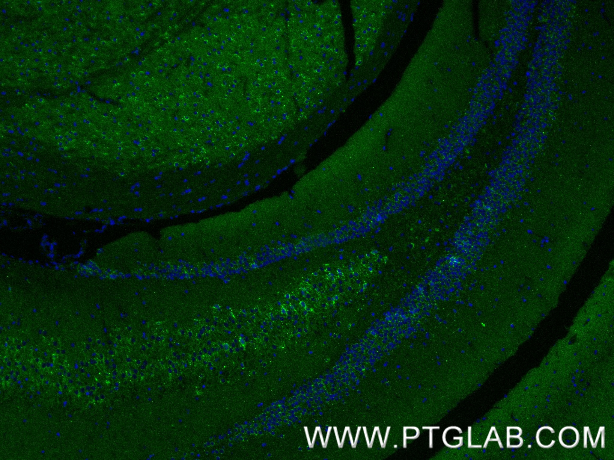 Immunofluorescence (IF) / fluorescent staining of mouse brain tissue using CX3CL1 Recombinant monoclonal antibody (83738-5-RR)