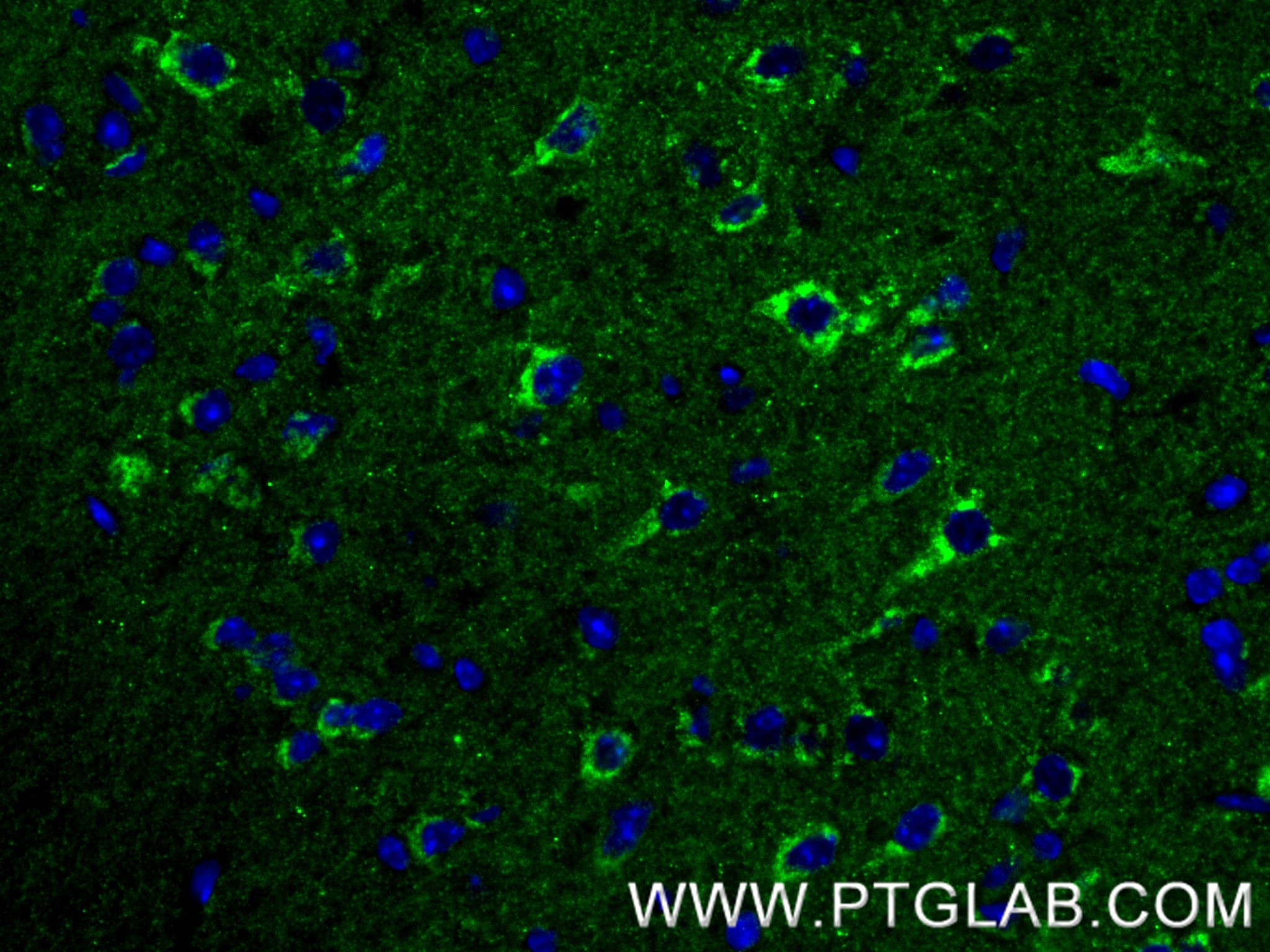 Immunofluorescence (IF) / fluorescent staining of mouse brain tissue using CX3CL1 Recombinant monoclonal antibody (83738-5-RR)