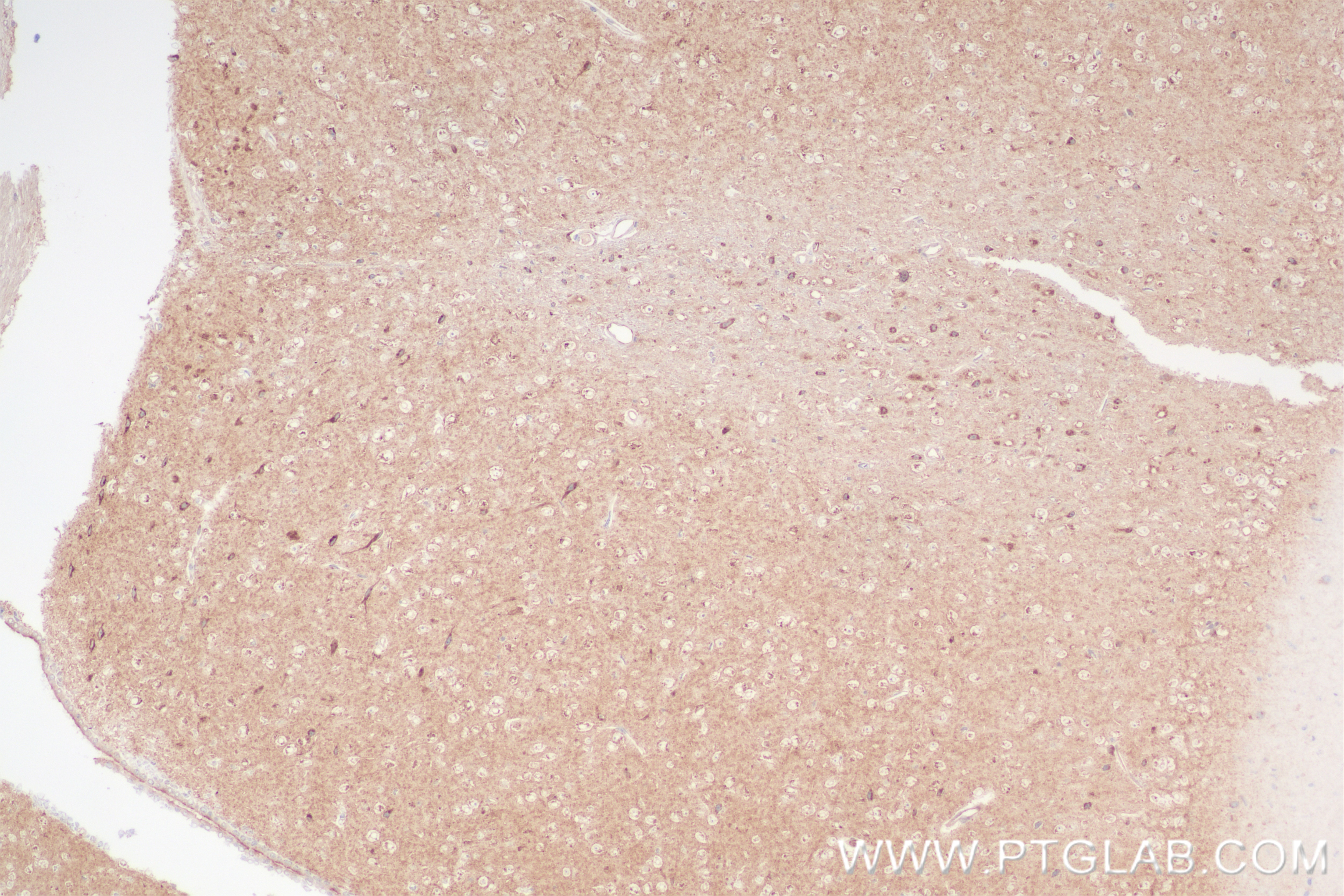 Immunohistochemistry (IHC) staining of mouse brain tissue using CX3CL1 Recombinant antibody (83738-5-RR)