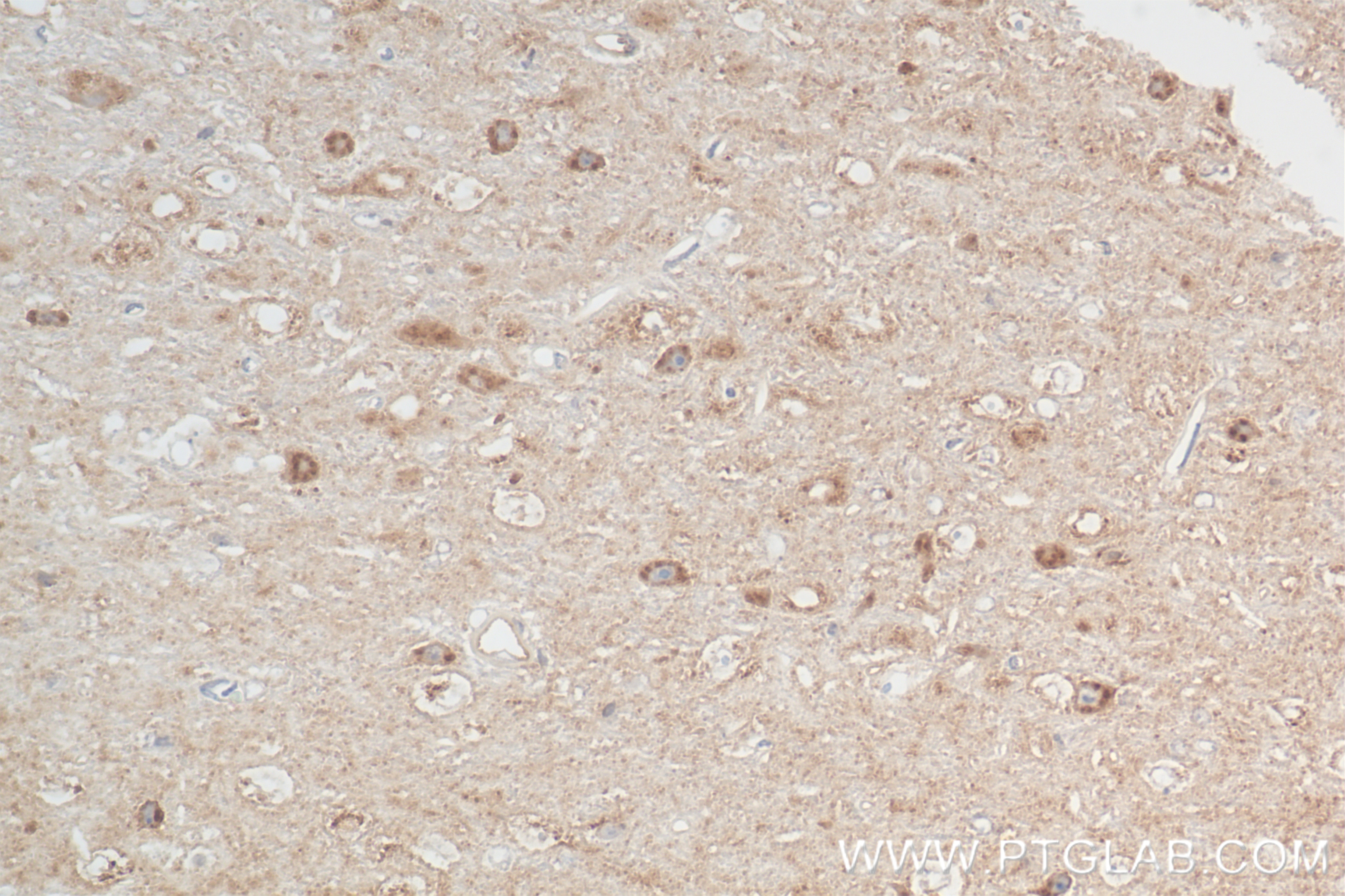 Immunohistochemistry (IHC) staining of mouse brain tissue using CX3CL1 Recombinant antibody (83738-5-RR)